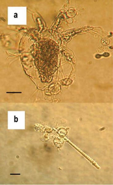 Batrachochytrium dendrobatidis  visible as transparent spherical bodies growing in lake water on (a) freshwater arthropod and (b) algae (Photo: Johnson ML, Speare R. via Wikimedia Commons )