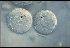 Oocyst: two developing oocysts of Plasmodium relictum on the stomach wall of the mosquito vector, Culex quinquefasciatus. The oocysts contain densely packed, long slender sporozoites (arrows) that are released at maturation and invade the salivary glands of the insect. The sporozoites are capable of infecting another bird with malaria when the mosquito takes another blood meal. (Photo: U.S. Geological Survey - Biological Resources Division)